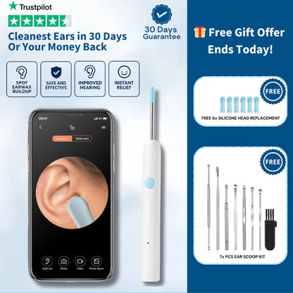 2026  Hot Sale 49% OFF🔥Earwax Removal Kit