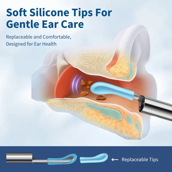 2026  Hot Sale 49% OFF🔥Earwax Removal Kit